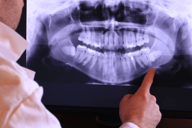 Best Emergency Treatment for Toothache in Wilton Manors, FL